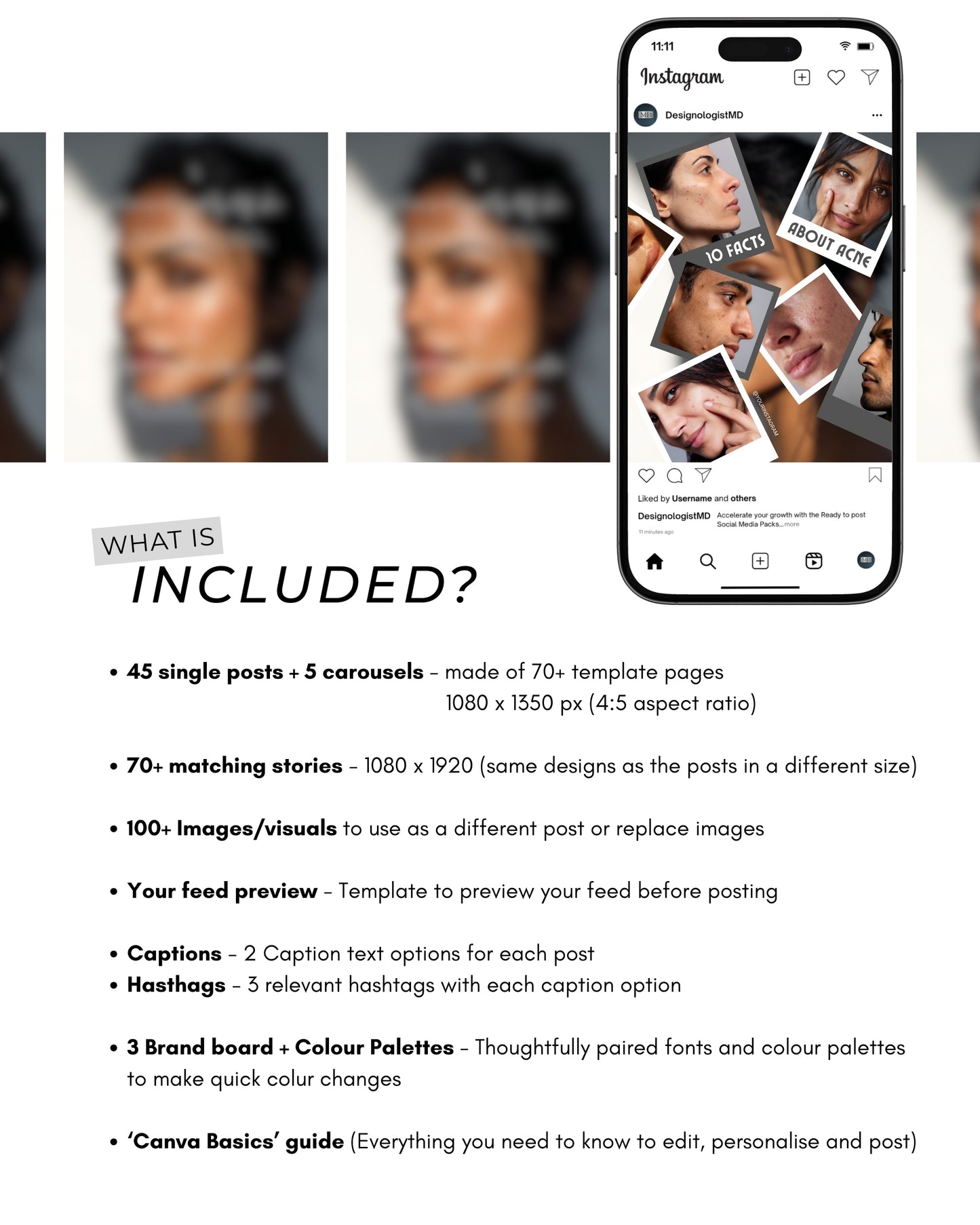 Acne Skincare Premium Plus Content Bundle