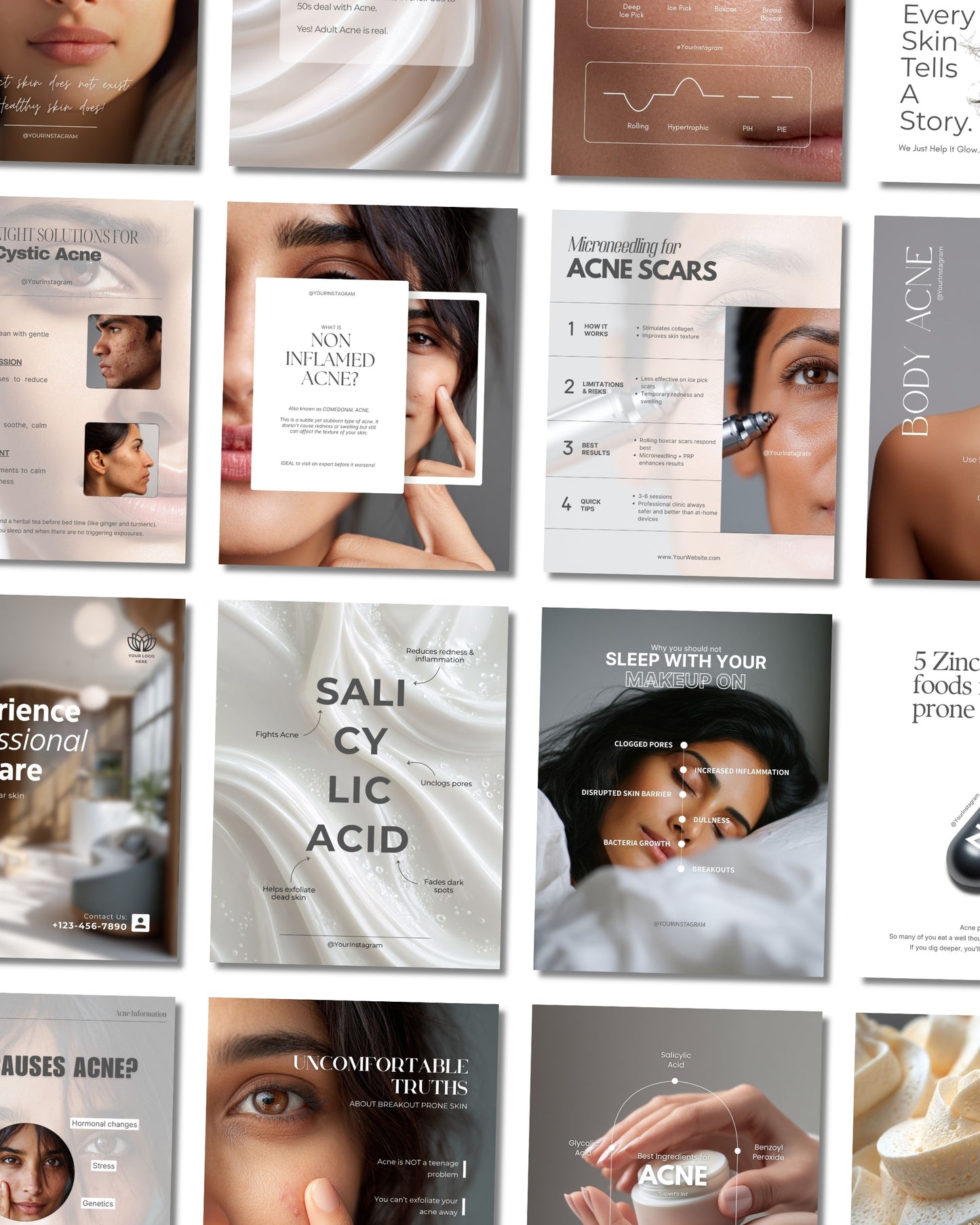 Acne Skincare Premium Plus Content Bundle